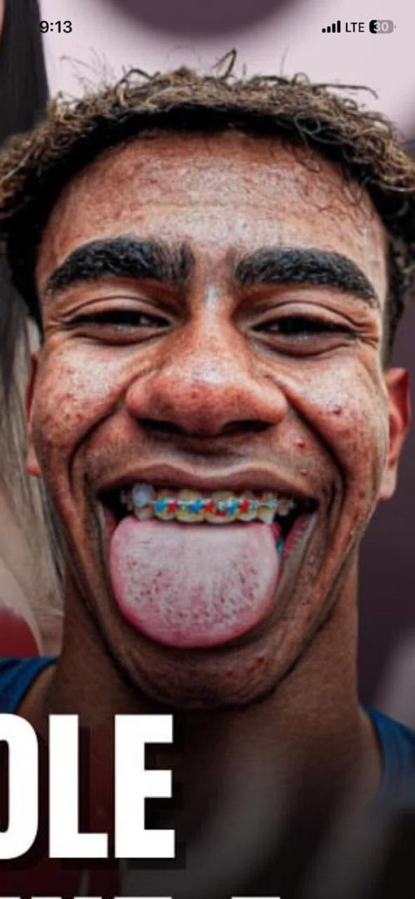 W